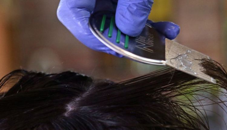 The Ultimate Guide To Lice Removal In Westchester